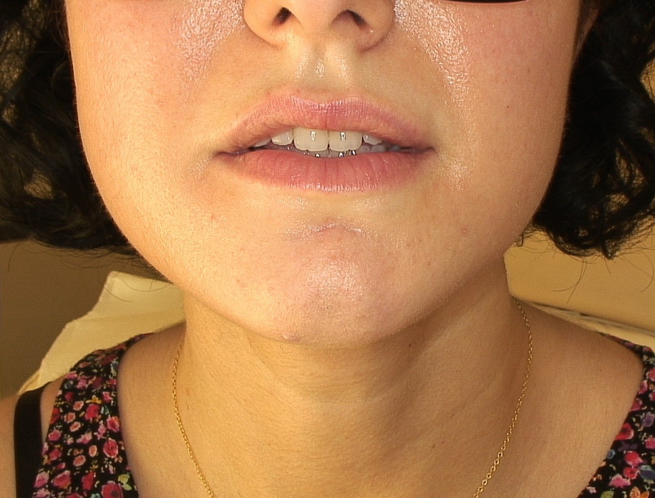 Before